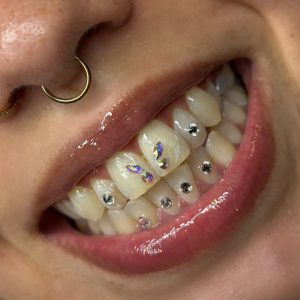 curso gemas dentales online